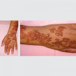 allergic contact rashes
